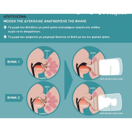 SUAVINEX Θηλές Σιλικόνης SX-Pro Zero Zero Γρήγορη Ροή (6+ μηνών)